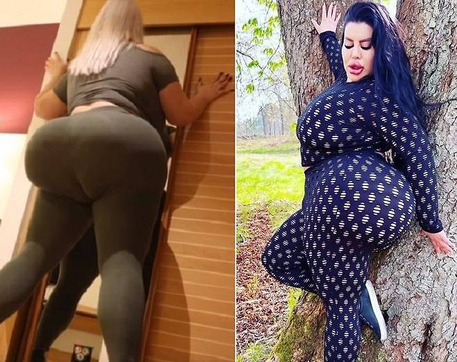 2억원을 들여 엉덩이 리프팅 시술을 받은 모델 나타샤 크라운. 출처=더선