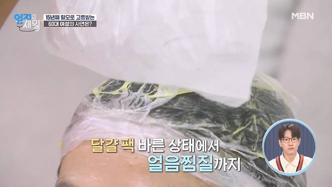 중년 탈모 공략법 달걀 팩과 얼음 찜질이 효과적이다? | 1일 1짤