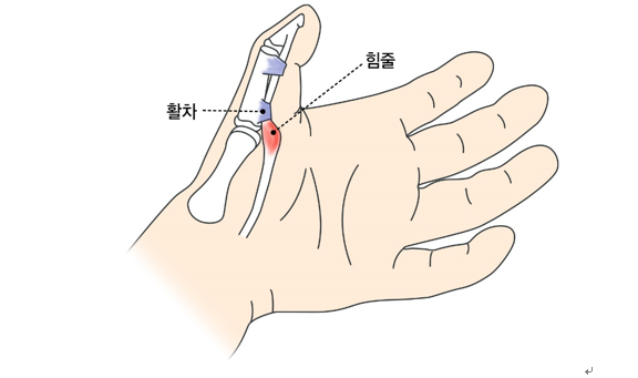 [강동경희대병원 제공]