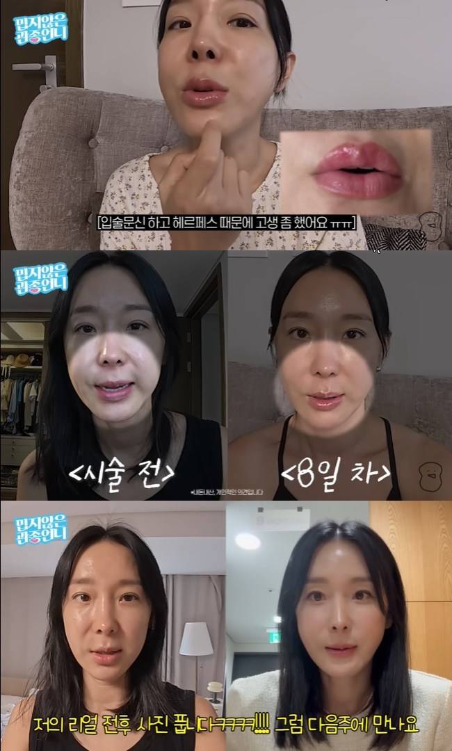 사진=‘밉지않은 관종언니’ 채널 영상 캡처