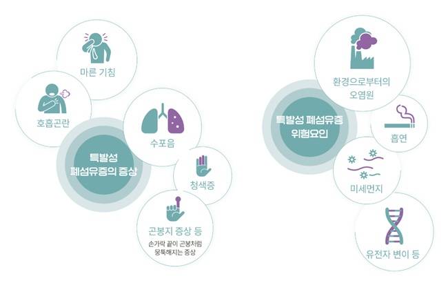 특발성 폐섬유증의 주요 증상과 위험요인. /이미지=충남대병원 홈페이지