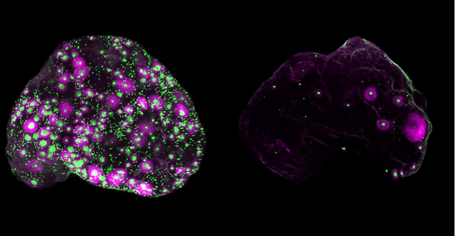 왼쪽은 생후 2개월(사람 약 20대 초반) 된 생쥐의 난소, 오른쪽은 12개월(사람 약 40세 전후) 된&nbsp;생쥐의 난소다. 녹색으로 표시된 점은 난자를 품은 ‘난포(follicle)’이며 나이가 들수록 그 수와 밀도가 눈에 띄게 줄어든다. 분홍색 부분은 성장 중인 난포를 나타낸다. Gaylord, et al. Science 제공