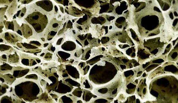 노화와 함께 찾아오며 일상을 위협하는 골다공증, 소리 없이 찾아오는 질환으로도 부른다. [사진=EBS]