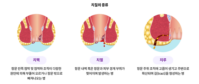 출처=보건복지부