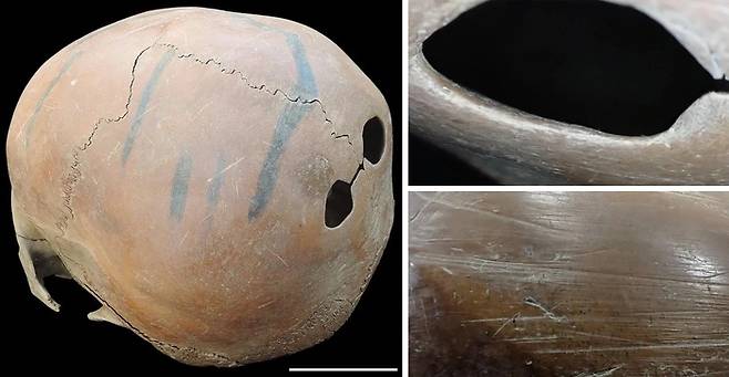 중국 량주 문화 유적지에서 발견된 가공된 사람 머리뼈. 사진=사와다 준메이/사이언티픽 리포트