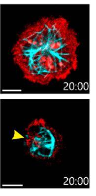 ▲그림1 위 그림에서 붉은 색은 액틴이고, 푸른 색은 미세소관이다. 위 그림은 보통 생쥐이고, 아래 그림은 CD99 단백질이 안 만들어진 T세포 내부를 촬영한 거다. 일반 생쥐의 T세포에서는 종양세포를 보면 액틴과 미세소관의 재구조화가 빠르게 일어나나, 아래 그림에서 보듯 CD99가 없으면 재구조화가 잘 일어나지 않는다. ⓒ최은영