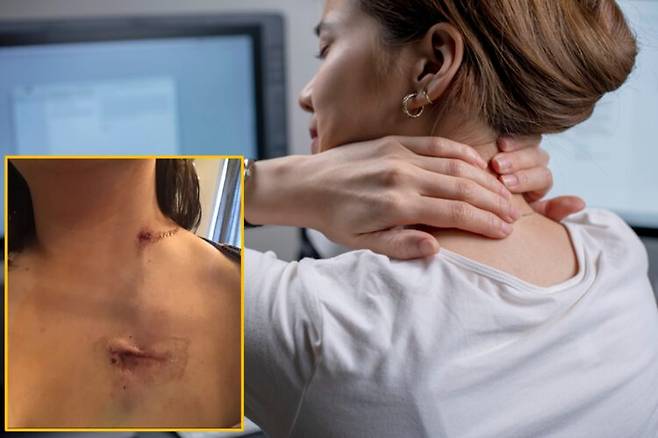 평소 업무로 노트북 앞에 오래 앉아 있던 한 여성이 어깨와 등의 통증을 단순한 자세 문제로 여기다 폐와 간으로 전이된 4기 유방암을 진단 받은 사연을 공유했다. 배경사진=게티이미지뱅크 / 좌측 하단=Embers Charit