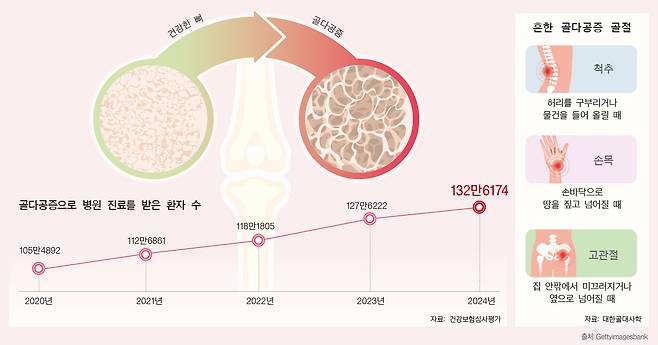 나이 들수록 뼈의 양이 줄고 뼈가 약해지면서 골다공증 발생 위험이 높아질 수 있어 주의해야 한다. [출처: Gettyimagesbank]