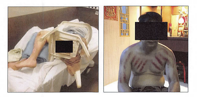 미 검찰 공소장에 첨부된 캄보디아 범죄조직 ‘프린스 그룹’이 행한 폭행과 고문, 감금 사진들