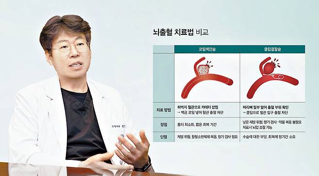 건국대병원 신경외과 전영일 교수는 "이미 뇌에 출혈이 생긴 후에는 추가 손상이 생기지 않도록 막는 치료를 한다"며 "환자 상태에 맞게 의료진은 개두술, 코일색전술 등을 고려한다"고 했다. /김지아 헬스조선 객원기자, 그래픽=김경아