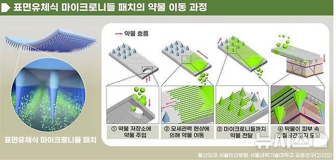 [서울=뉴시스] 표면유체식 마이크로니들 패치의 약물 이동 과정. (사진= 서울아산병원 제공)