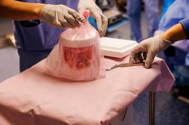 지난 1월 미국의 60대 남성 말기 신부전 환자 팀 앤드루스 몸에 돼지 신장이 이식되는 모습. 미국 매사추세츠 종합병원 제공