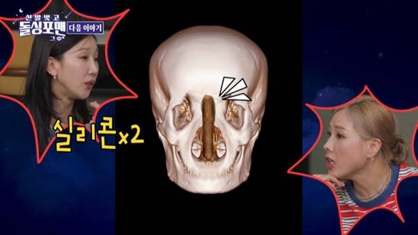 SBS ‘돌싱포맨’