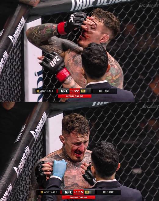 ▲ 시릴 간의 손가락에 눈을 찔린 뒤 통증을 호소하고 있는 톰 아스피날.