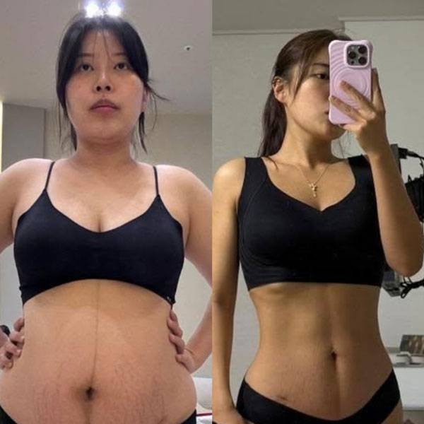 다이어트 전(왼)과 후(오) 김현아씨의 모습./사진=김현아씨 제공