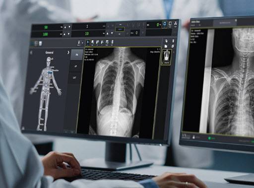 뷰웍스 디지털 의료영상 획득 및 처리 소프트웨어 VXvue