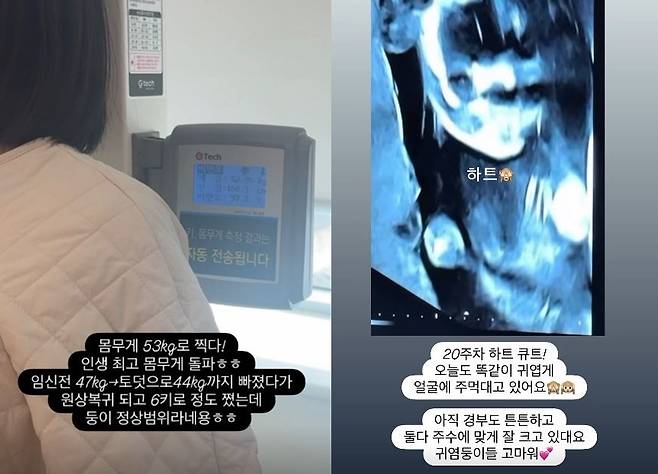 초아 소셜미디어