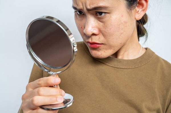 색소 침착은 한 번 생기면 짙게 남아 잘 사라지지 않고, 치료 과정도 길어 많은 이들의 고민거리다./사진=클립아트코리아