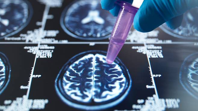 콜린알포세레이트는 뇌 기능과 관련된 인지 기능 개선을 위한 약물이다|출처: 클립아트코리아