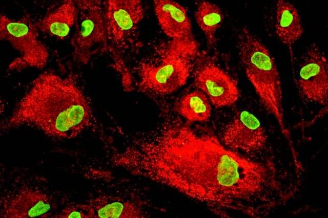 형광 염색으로 본 중간엽줄기세포(MSC)의 현미경 이미지 (사진=anova-irm)