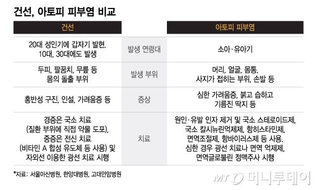 건선, 아토피 피부염 비교. /그래픽=이지혜 디자인기자