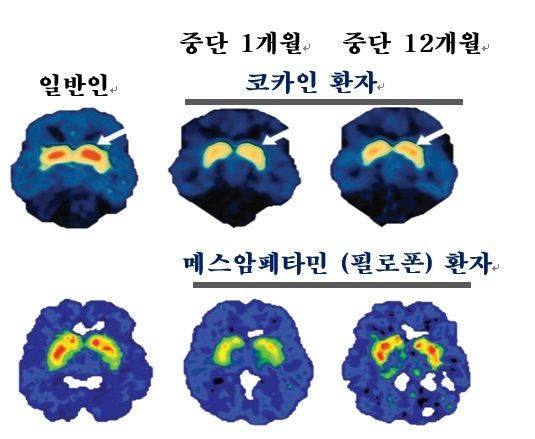 중독에 빠지지 않는 법 [안철우 교수의 호르몬 백과사