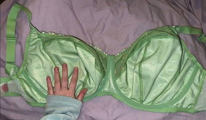 유방이 계속 커지는 거대유방증을 앓는 서머 로버트가 자신의 가슴 크기를 가름 할 수 있도록 브래지어를 공개했다. 출처=데일리메일