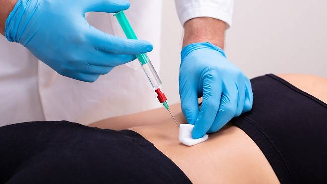 신경차단술은 완전 비수술 치료 이후에도 증상 개선이 되지 않으면 고려할 수 있다｜출처: 클립아트코리아