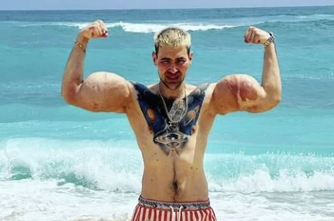 ⓒ키릴 테레신 SNS 갈무리