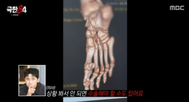 사진제공=MBC 캡처&nbsp;