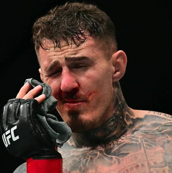 ▲ 시릴 간이 뻗은 손가락에 눈을 찔린 뒤 고통스러워하는 톰 아스피날.