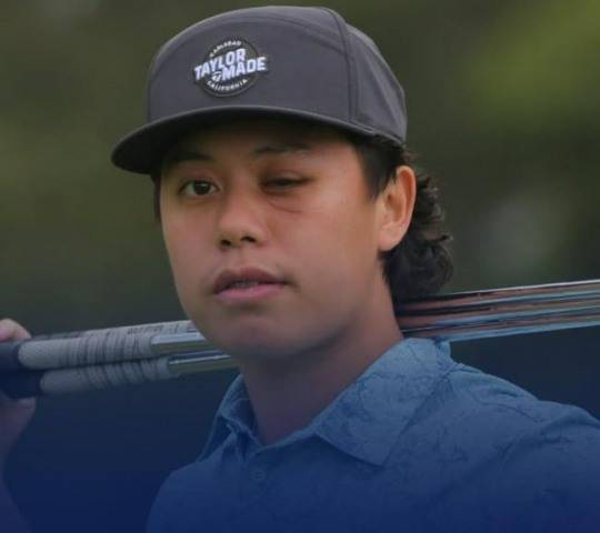 대회 중 공에 맞아 왼쪽 눈을 실명한 뒤 1년 만에 복귀한 호주 골프 선수 제프 관. 사진[연합뉴스]