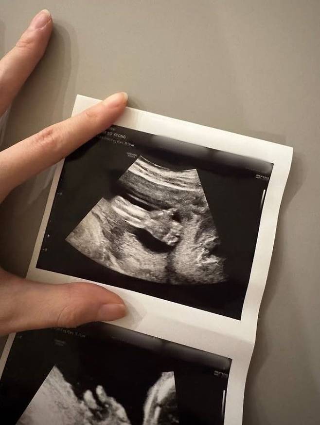 [서울=뉴시스] 아나운서 출신 방송인 오상진·김소영 부부가 둘째를 품에 안게 됐다. 김소영은 5일 자신의 소셜미디어에 둘째 초음파 사진을 공개하며 "우리 가족에게 또 한 명의 아기가 찾아왔다"고 둘째 임신 소식을 전했다. (사진=김소영 인스타그램 캡처) 2025.12.06. photo@newsis.com *재판매 및 DB 금지