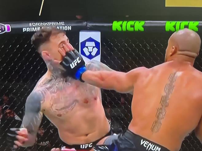 ▲ 시릴 간(오른쪽)의 손가락이 톰 아스피날의 오른쪽 눈을 깊숙히 찔렀다.