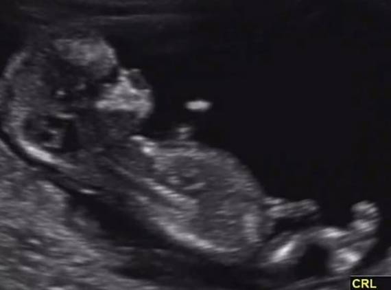 /사진=최연수 인스타그램