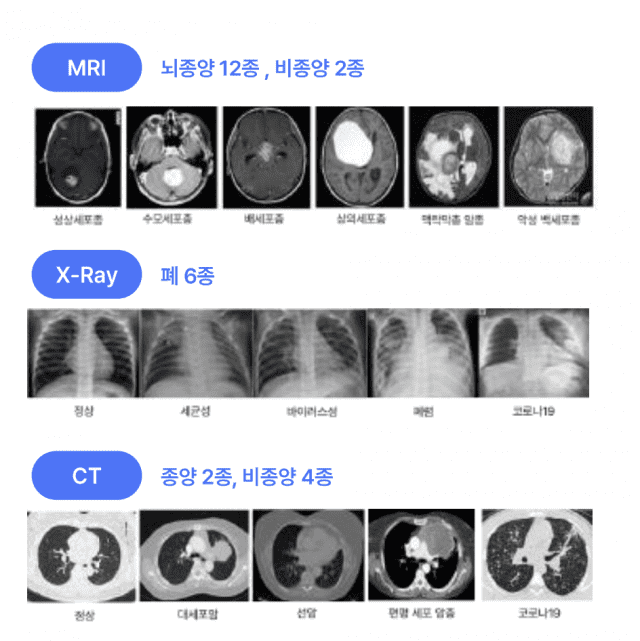 브이더블유원이 보유한 26개의 병변을 분류할 수 있는 분석기술은 90% 이상의 정확도를 자랑한다. (사진=강원TP)