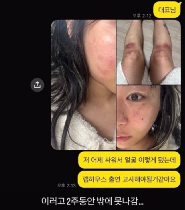 An Instagram post by rapper Jvcki Wai in which she said she was beaten by her former lover Vangdale [SCREEN CAPTURE]