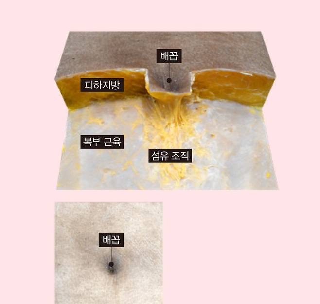 배꼽집 구조(위)와 오목한 배꼽의 생김새. Satoru Muro et al. 제공