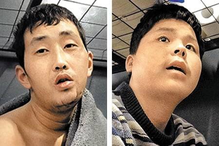 우크라이나군에 생포된 러시아 파병 북한군 포로 리모(왼쪽)씨와 백모씨./정철환 기자