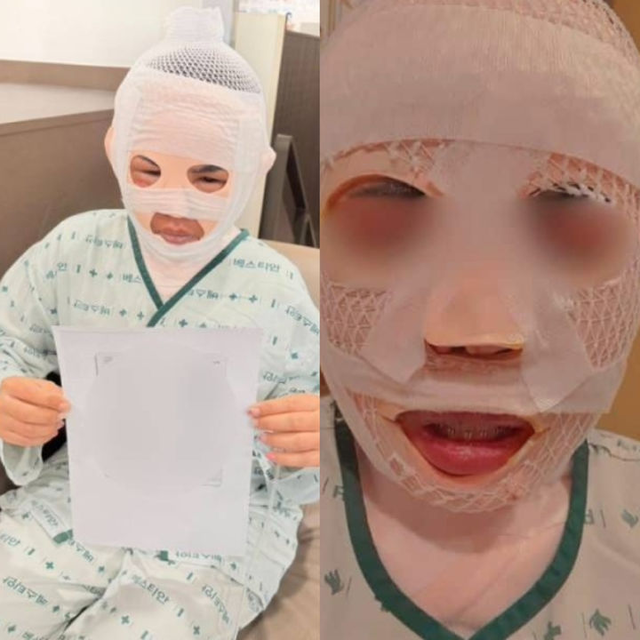 태국인 아내가 피해를 호소하며 올린 사진. 페이스북 갈무리