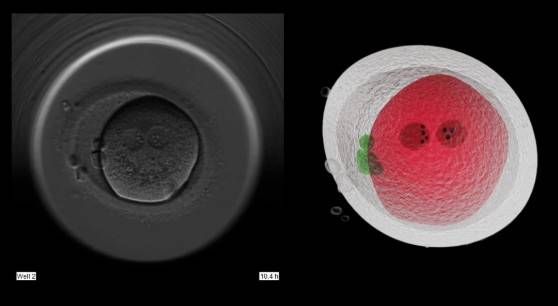 정자·난자를 수정한 배아 촬영 현미경 이미지(왼쪽)와 3차원 분석 사진. 싱가포르 난임 클리닉인 젠프라임은 배아 구조와 발달 상태를 입체적으로 분석한 데이터를 바탕으로 인공지능이 직접 착상 가능성이 가장 높은 배아를 선별한다. [젠프라임]
