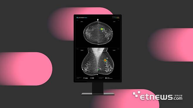 루닛 유방촬영술 AI 영상분석 솔루션 '루닛 인사이트 MMG'