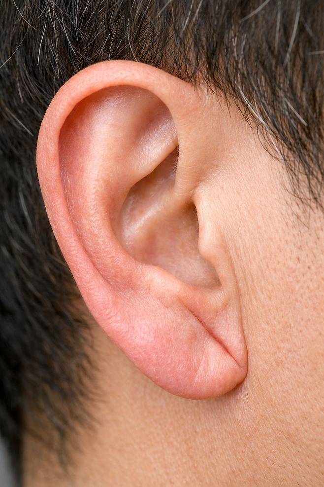 프랭크 징후(Frank’s sign)는 귓불에 사선으로 깊게 파인 주름으로, 최근 심뇌혈관질환 및 뇌소혈관 손상과의 연관성이 제기되고 있다. [AI 생성 이미지]