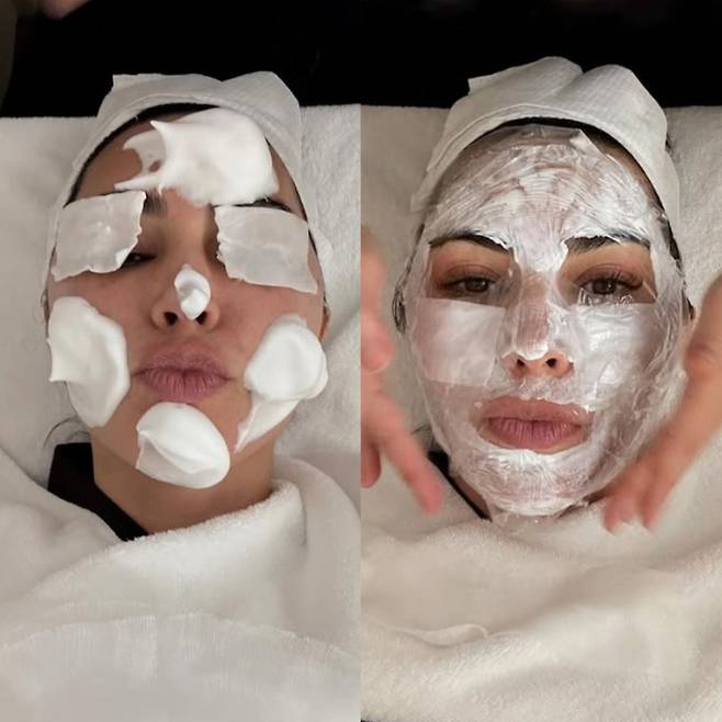 미국의 유명 모델인 킴 카다시안이 최근 서울 피부과를 찾아 시술을 받는 모습./킴 카다시안 인스타그램