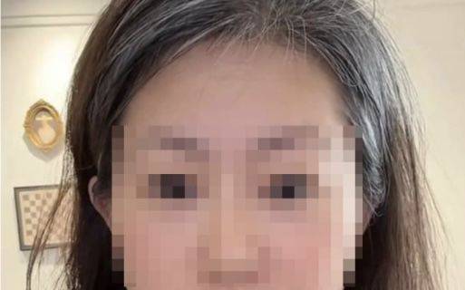 20년 지기 절친과 남편의 불륜 사실을 알게 된 뒤 극심한 스트레스로 "하룻밤 사이 머리카락이 하얗게 변했다"고 주장한 한 중국 여성의 사연이 재판으로 이어지며 다시 주목받고 있다.2026.01.12.(사진=바이두 캡처) *재판매 및 DB 금지