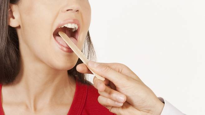 아무리 양치를 해도 입냄새가 느껴진다면 편도결석을 의심해 봐야한다 | 출처: 클립아트코리아