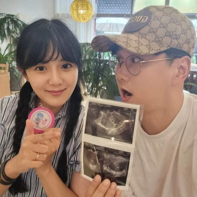 강은비, 40세 첫 임신 끝에 21주 이별…“보내줘야 했다”