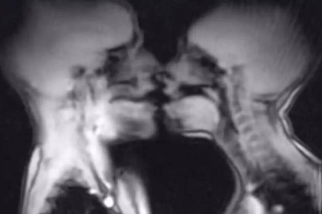 과학적 발견을 위해 자기공명영상(MRI) 기계 안에서 성관계를 한 커플의 실험이 25년이 지난 지금도 의학계의 흥미로운 사례로 회자되고 있다. 사진=BMJ(British Medical Journal)