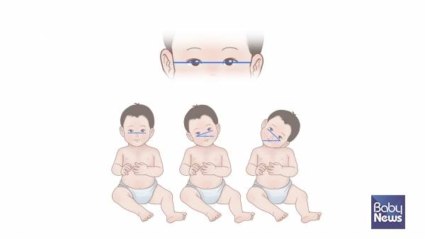 정상적인 머리와 목의 자세 및 기울기 측정법. ⓒ임신영