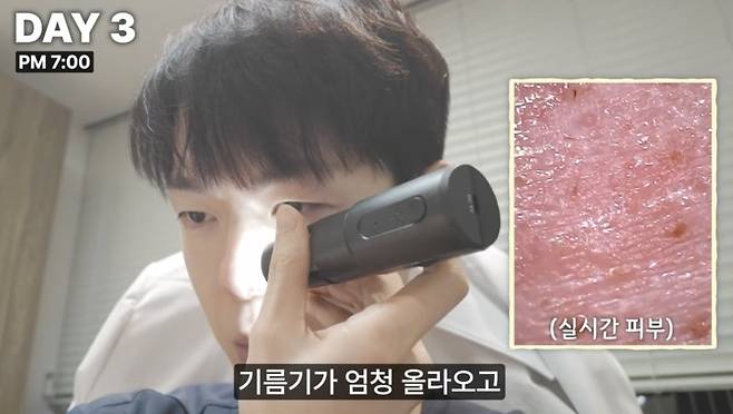 피부과 전문의가 평소 피부에 좋지 않다고 경고해온 음식만 일부러 섭취하는 실험을 진행한 결과, 단 일주일 만에 피부 나이가 5살이나 증가한 것으로 나타났다./사진=유튜브 채널 ‘피친남이승주’